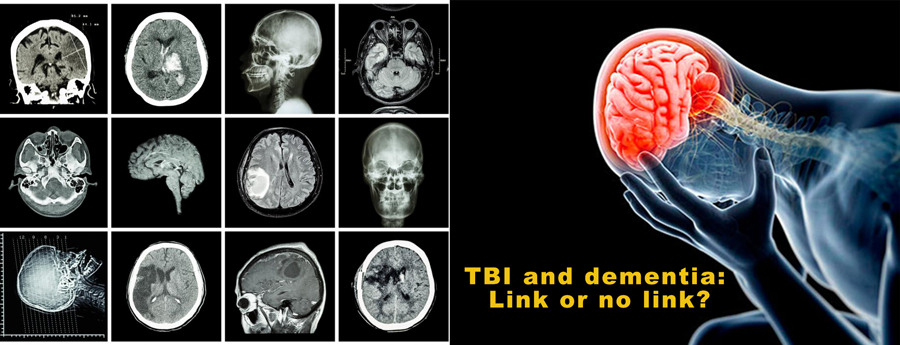 TBI and dementia: Link or no link?